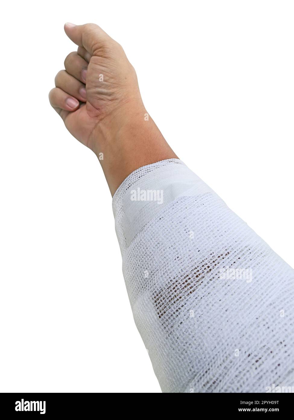 Injured hand bandage hi-res stock photography and images - Alamy