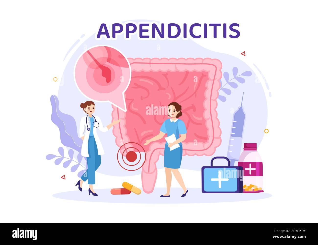 Appendicitis Illustration with Inflammation of the Appendix and Stomach Treatment in Healthcare Flat Cartoon Hand Drawn for Landing Page Templates Stock Photo