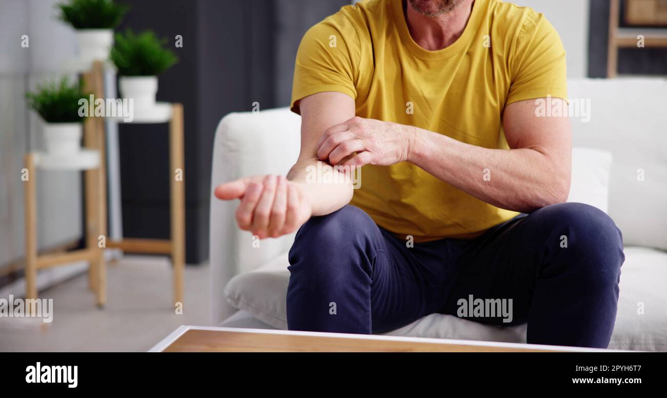 Man With Itchy Skin Stock Photo