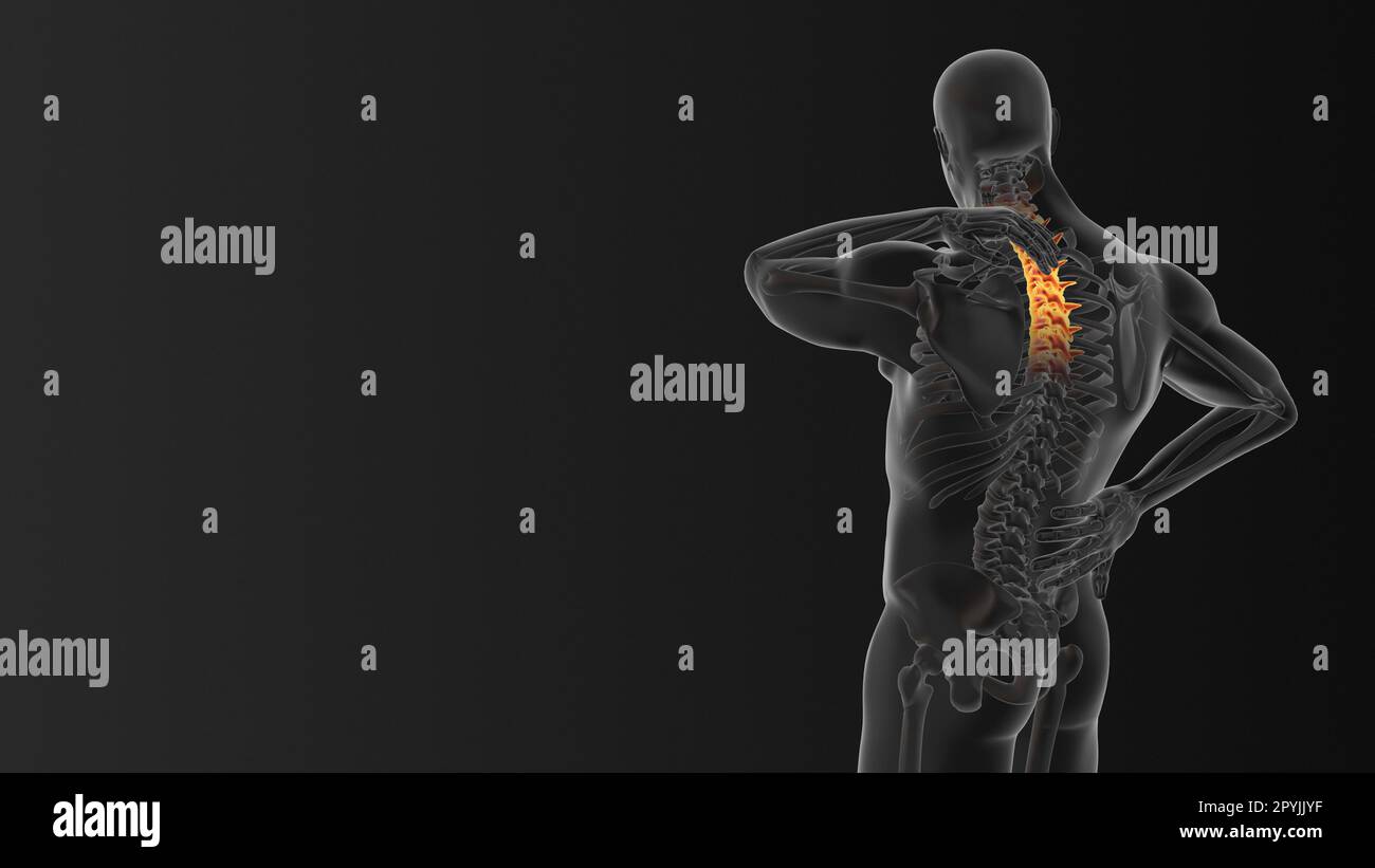 Cervical vertebral pain medical animation Stock Photo Alamy