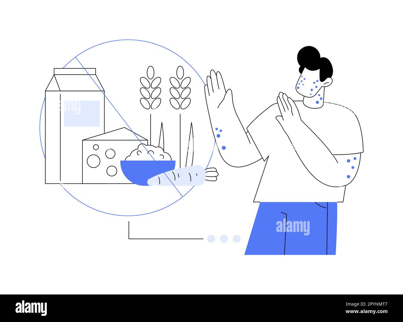 Food allergy abstract concept vector illustration Stock Vector Image