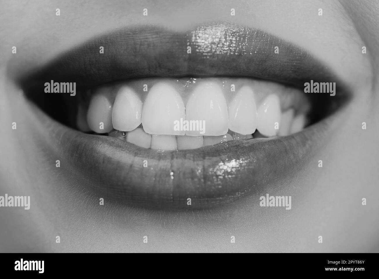 Laughing woman mouth with great teeth. Perfect smile after bleaching