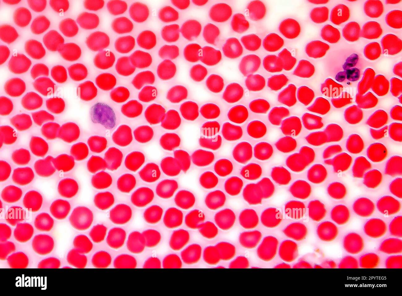 Human blood smear under microscope, light photomicrograph Stock Photo