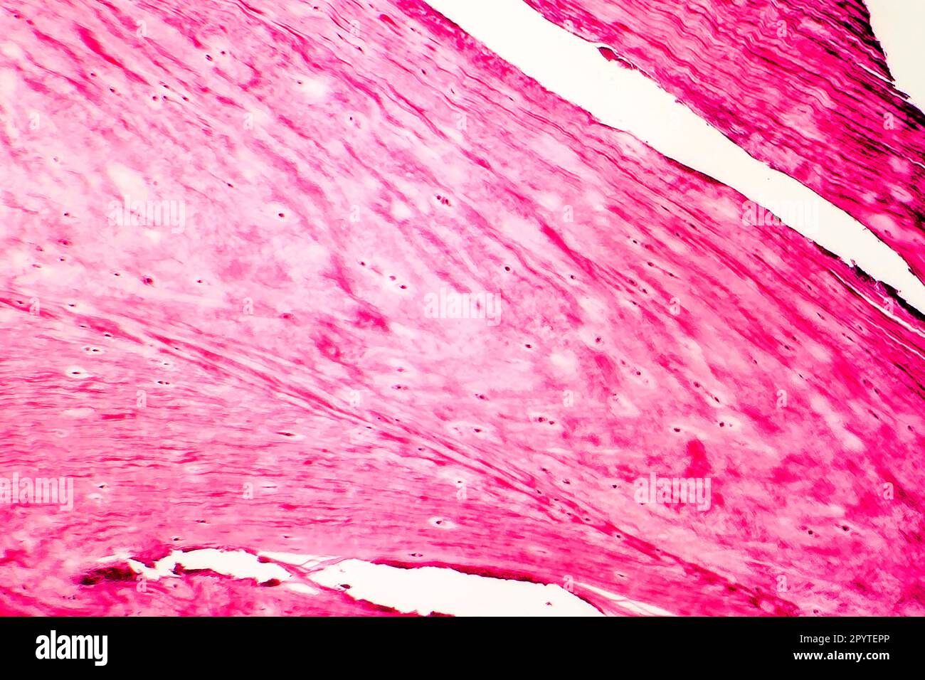 Fibrous cartilage, light micrograph. High magnification. Hematoxylin and eosin staining Stock Photo