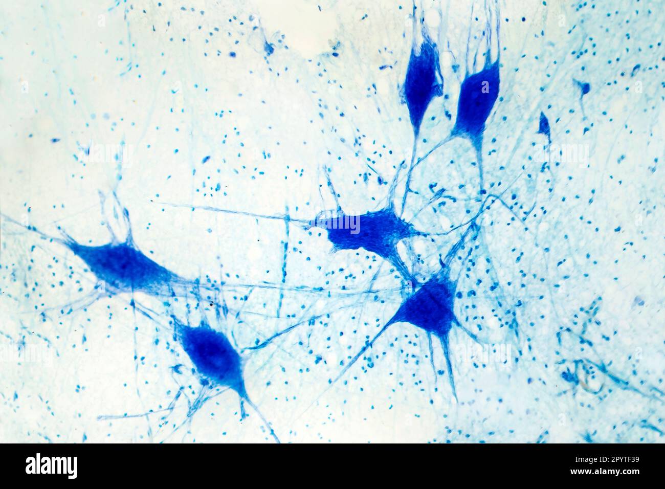 Light micrograph of human brain tissue showing neurons and glial cells