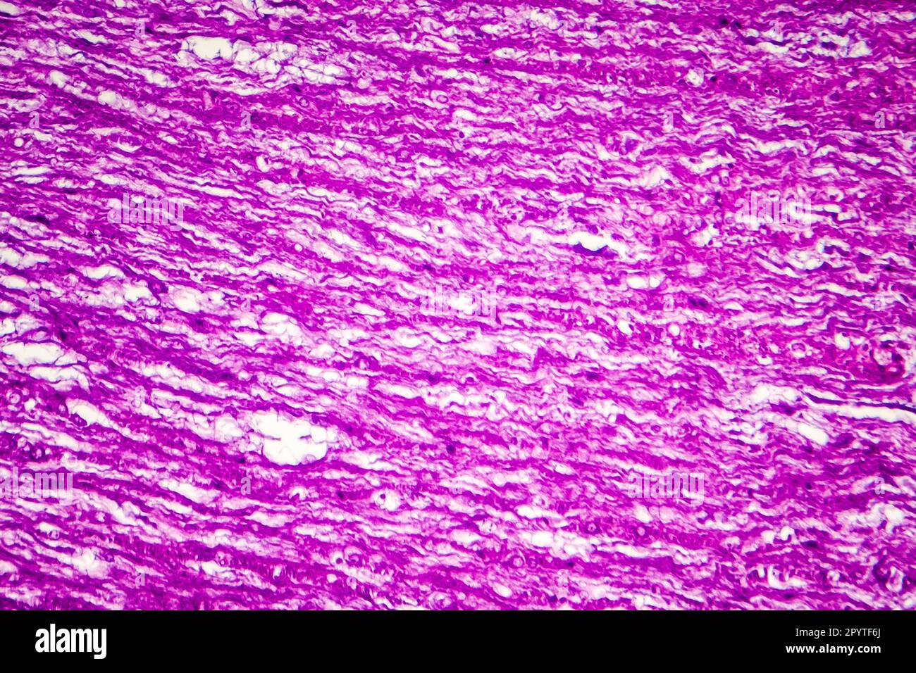 Human spinal cord, longitudinal section, light photomicrograph Stock ...
