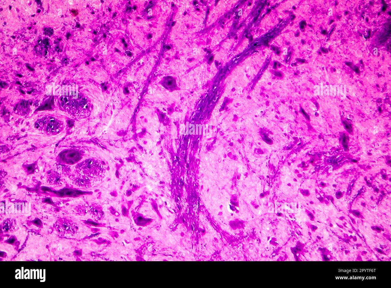 Human spinal cord, close-up view, light photomicrograph Stock Photo