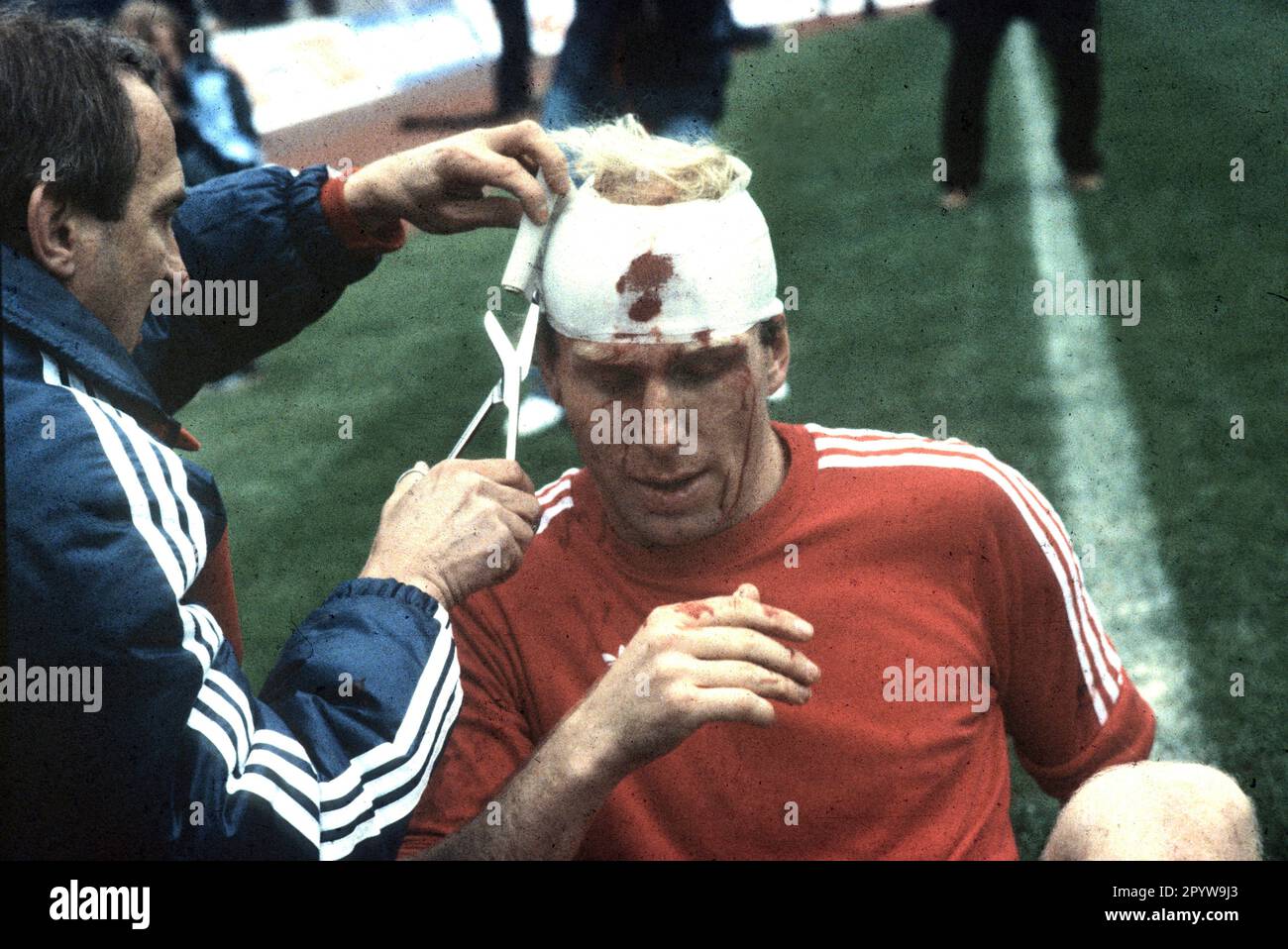 DFB Cup final FC Bayern Muenchen - 1. FC Nuernberg 4:2 /01.05.1982/ Dieter Hoeneß (FCB) injured head gets head bandage applied [automated translation] Stock Photo