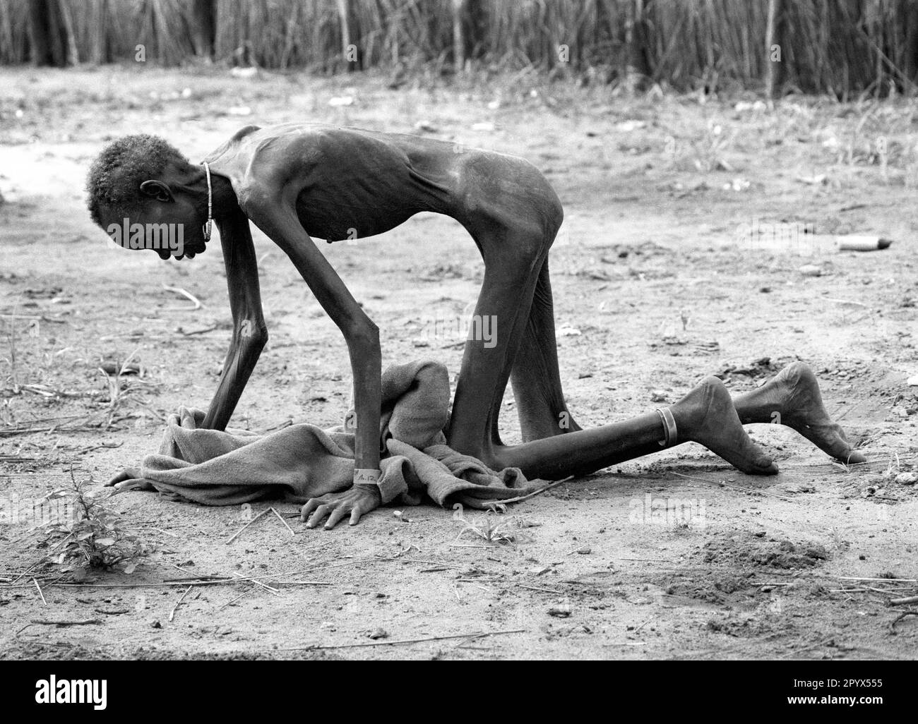 SDN , SUDAN : A starving woman in a feeding centre in Ayod in the south of Sudan 10.08.1993 Stock Photo