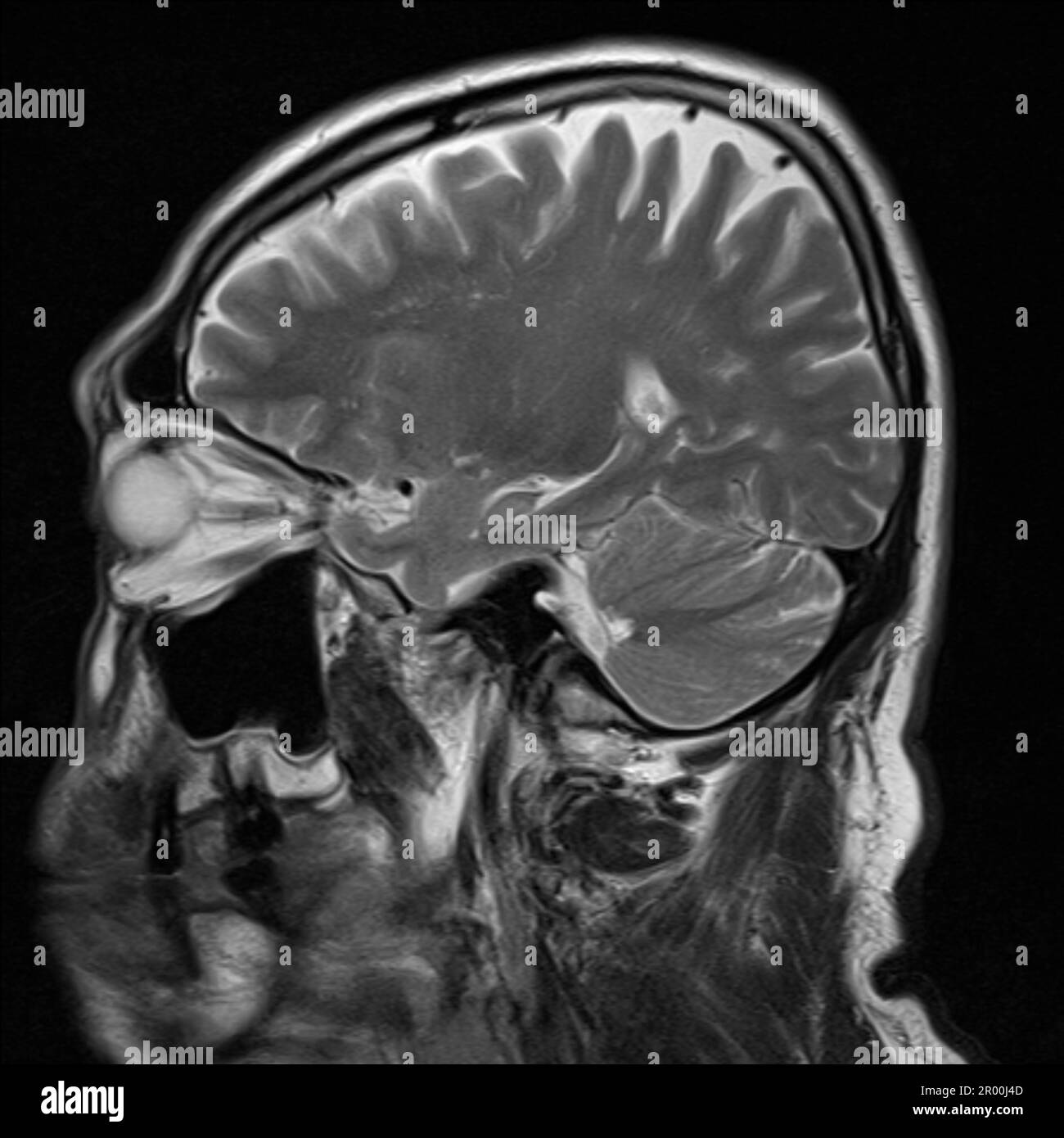 Healthy Human Brain Mri Scan Stock Photo Alamy