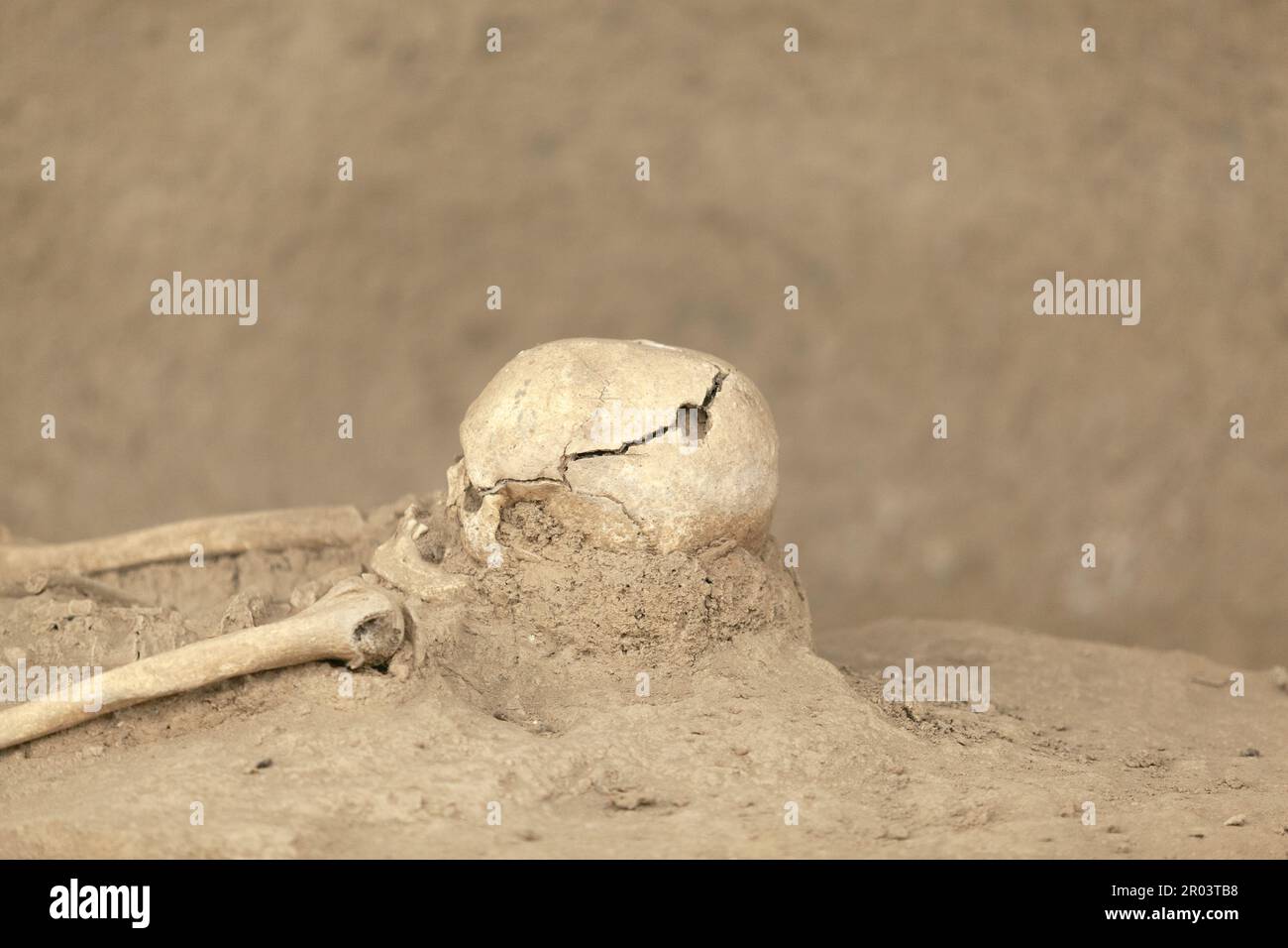 Roman skeleton with trepanned surgical intervention skull burr hole Stock Photo
