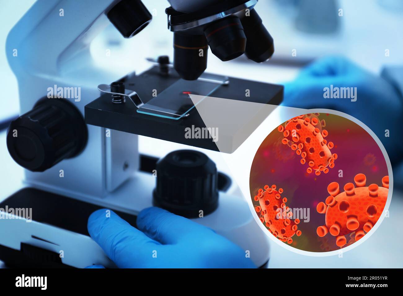 Monkeypox microscope hi-res stock photography and images - Alamy