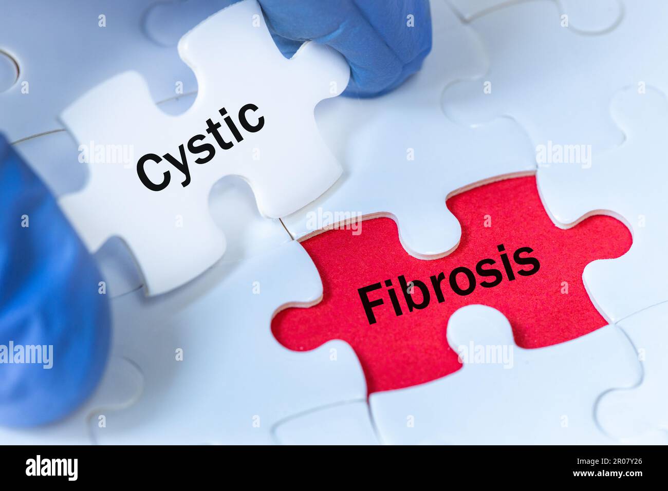 Cystic fibrosis (CF) is a rare genetic disease that affects not only ...