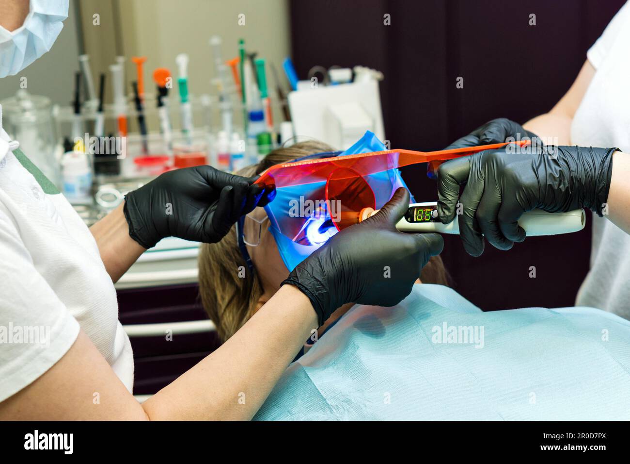 Restoration chewing surface with photopolymer filling material. Dentist