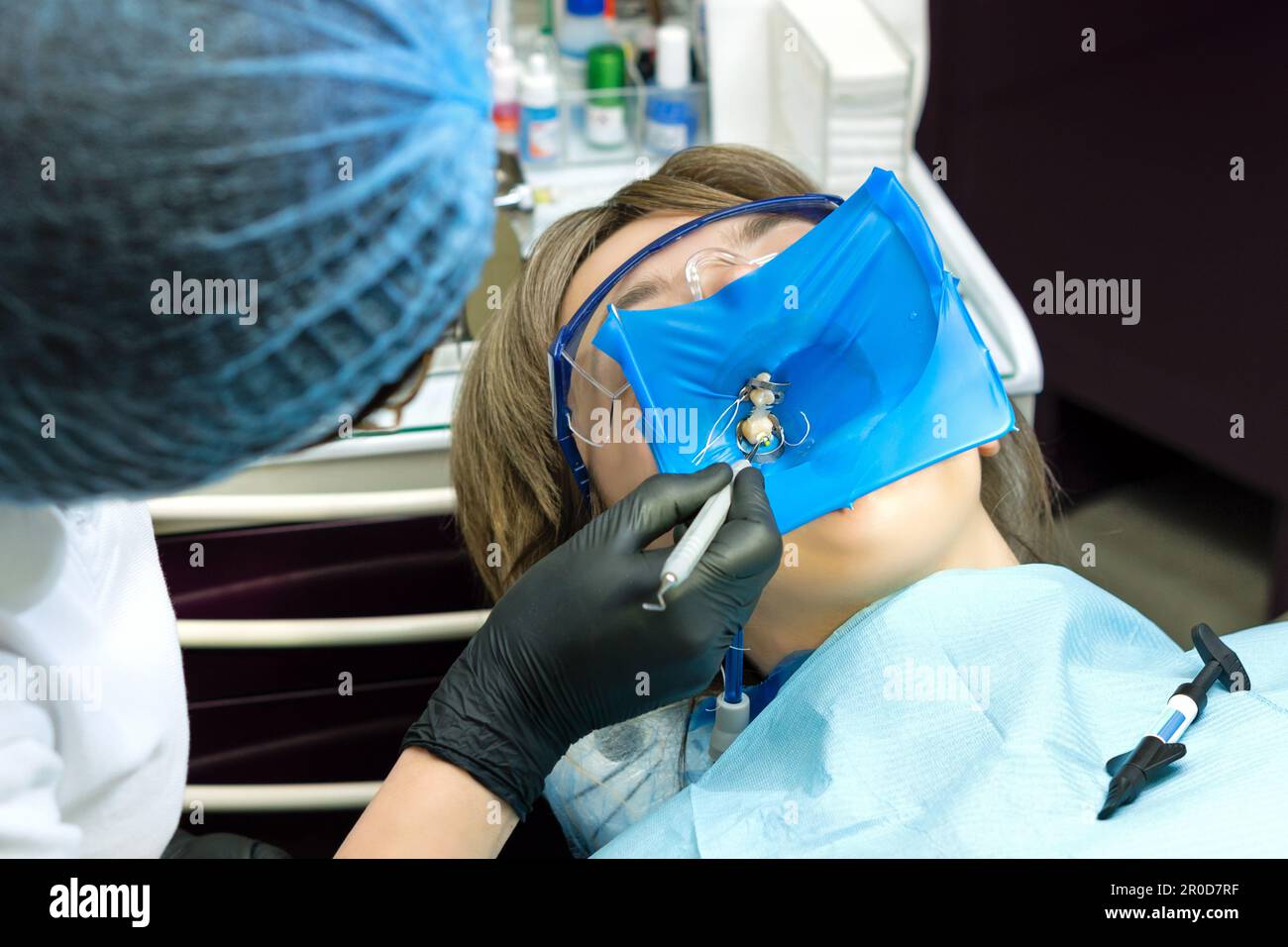 Doctor dentist using of rubber dam system with latex scarves and metal