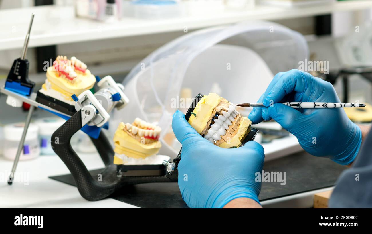 Dental prosthesis work. Denture work. Teeth painting. Dental technician