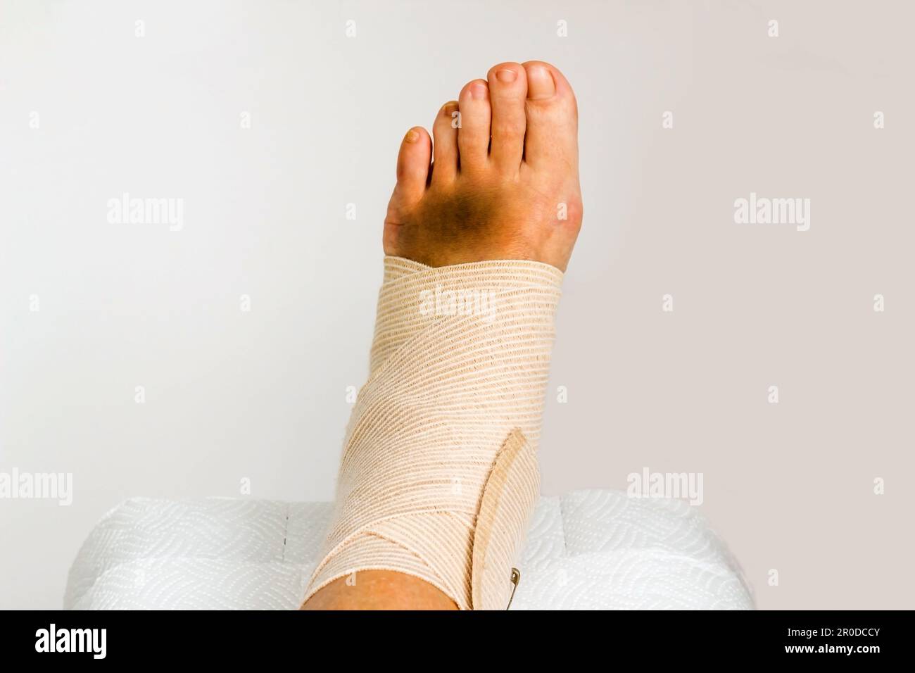 Medical bandage correctly wrapped around female sprained left ankle,close up taken Stock Photo