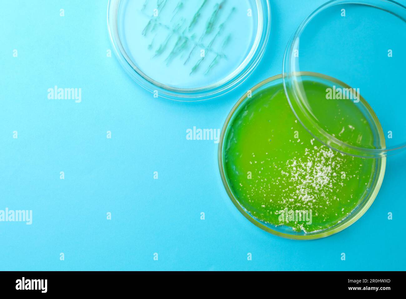Petri dishes with different bacteria colonies on light blue background ...