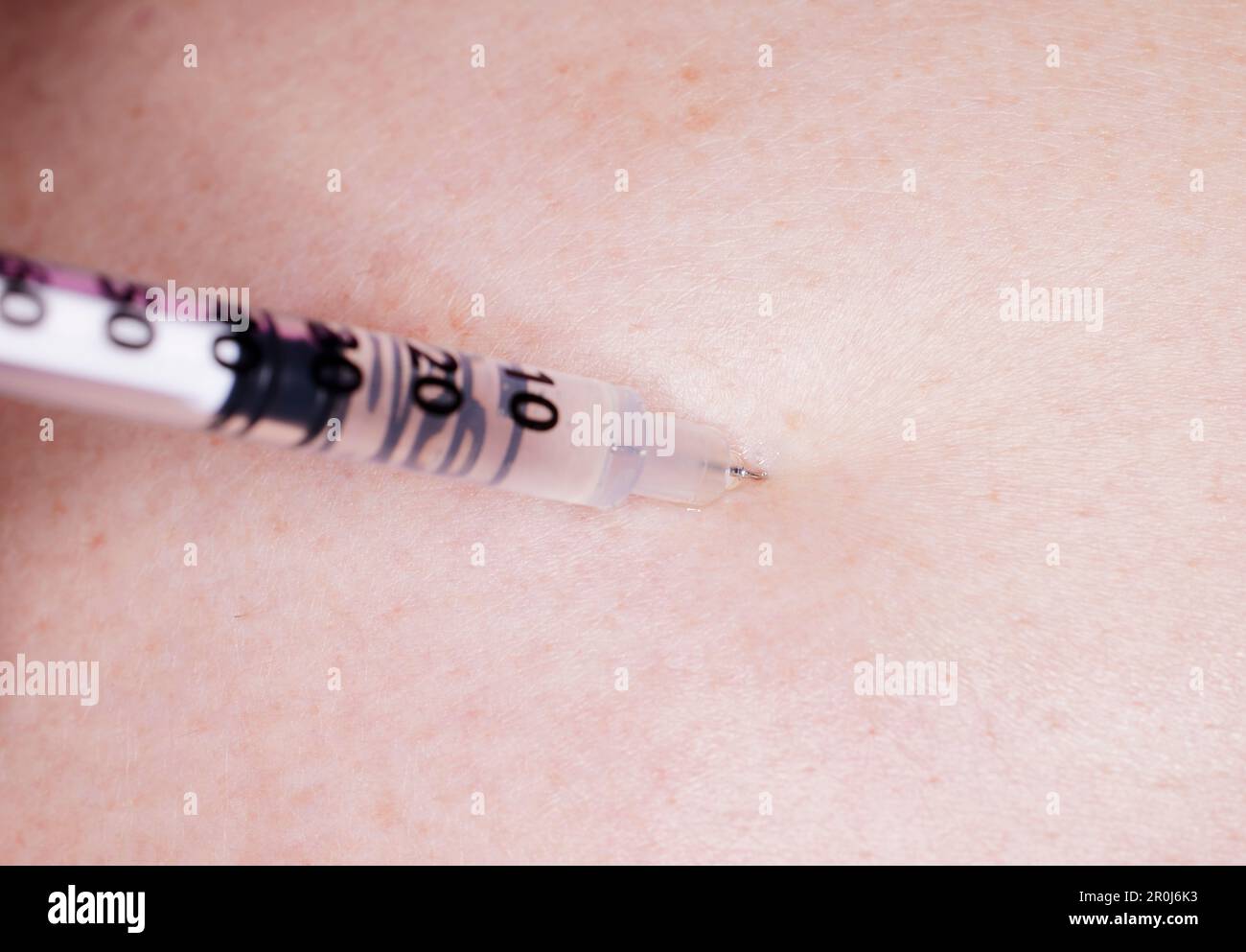Close up of needle and syringe filled with Testosterone puncturing the