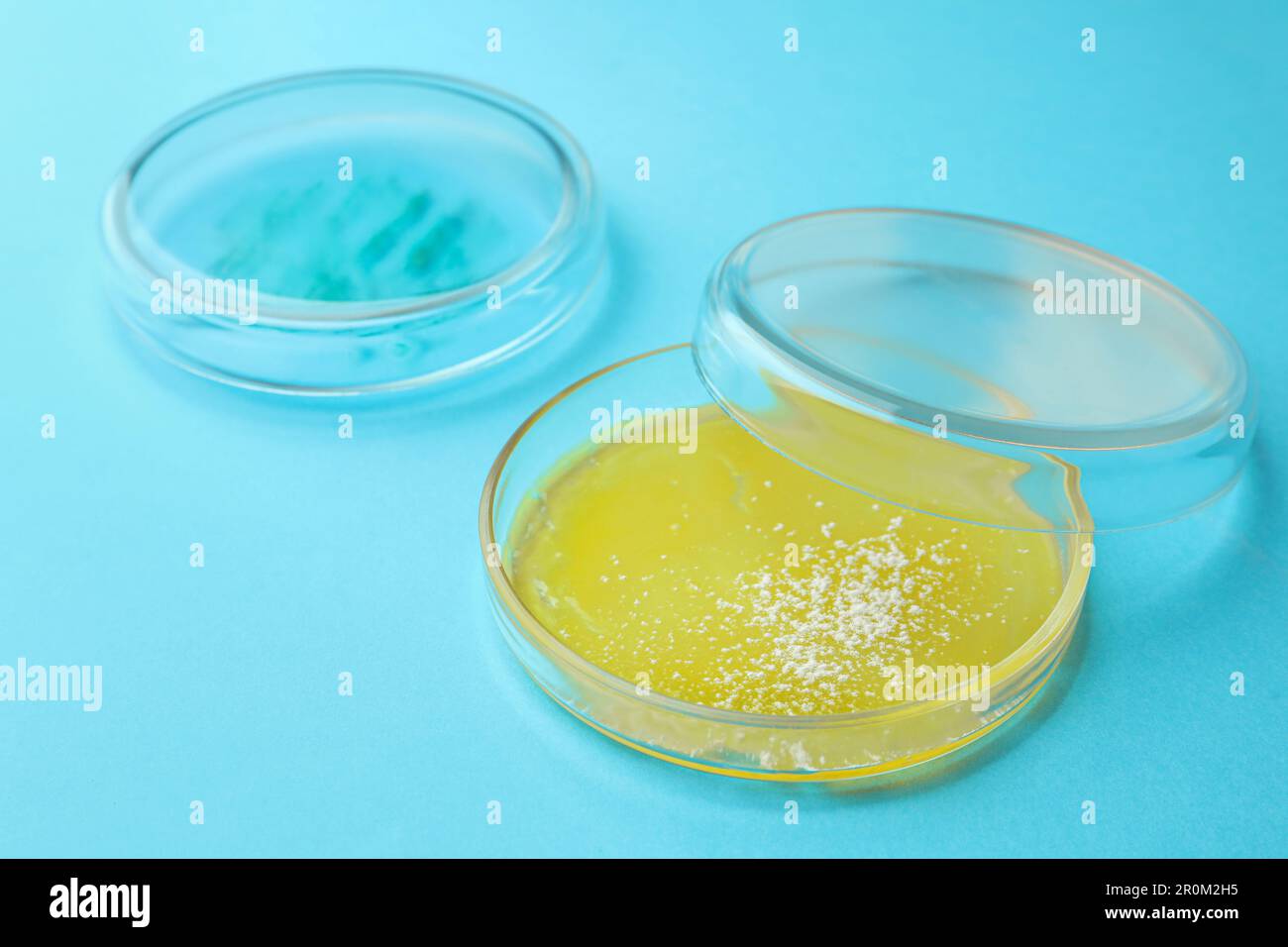 Petri dishes with different bacteria colonies on light blue background ...