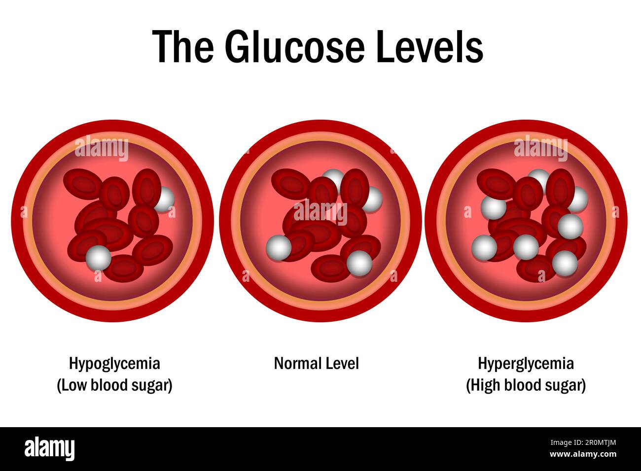 Blood Glucose Levels. normal level, hyperglycemia and hypoglycemia, 3d