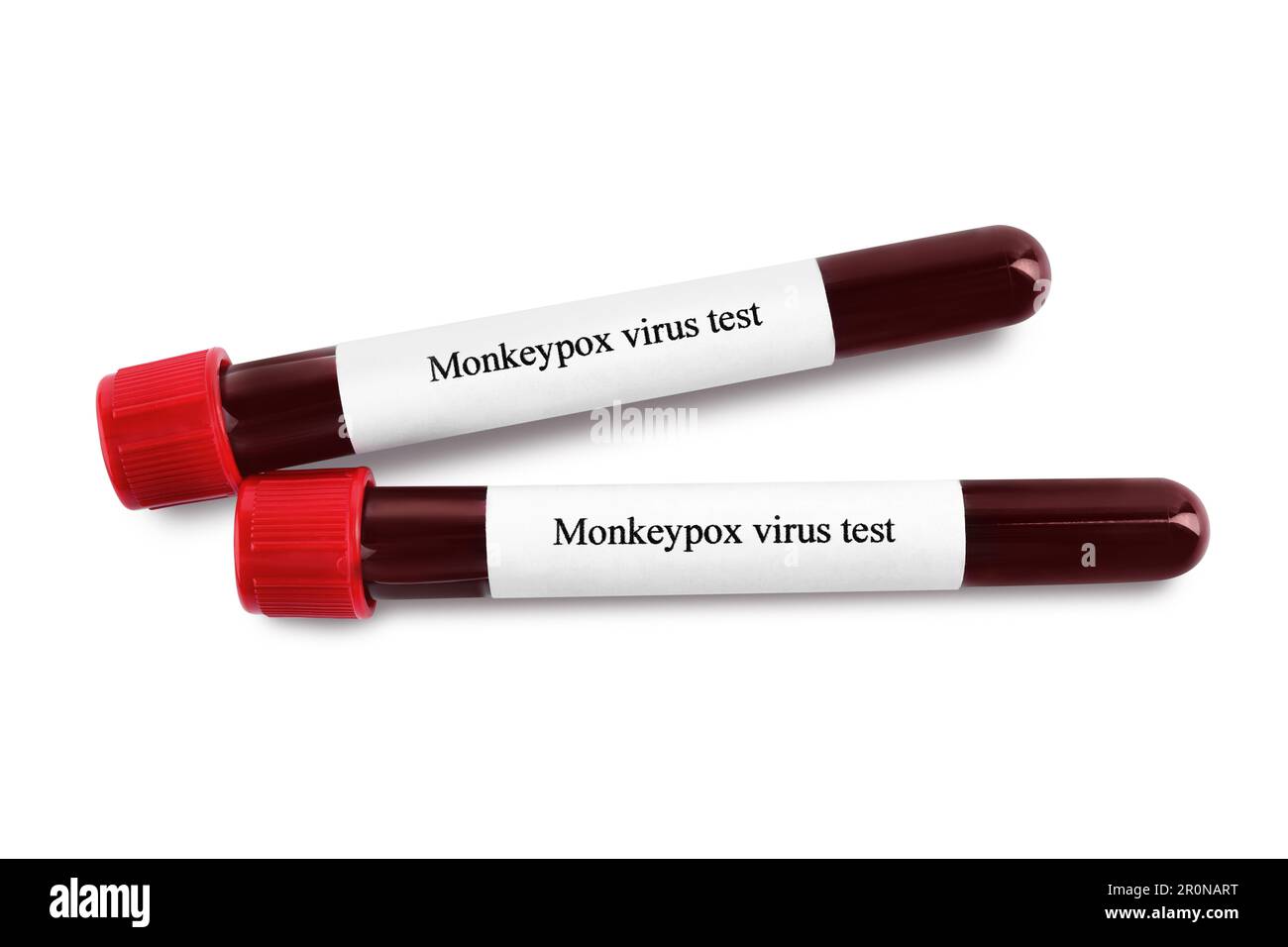 Monkeypox virus test. Sample tubes with blood on white background Stock ...