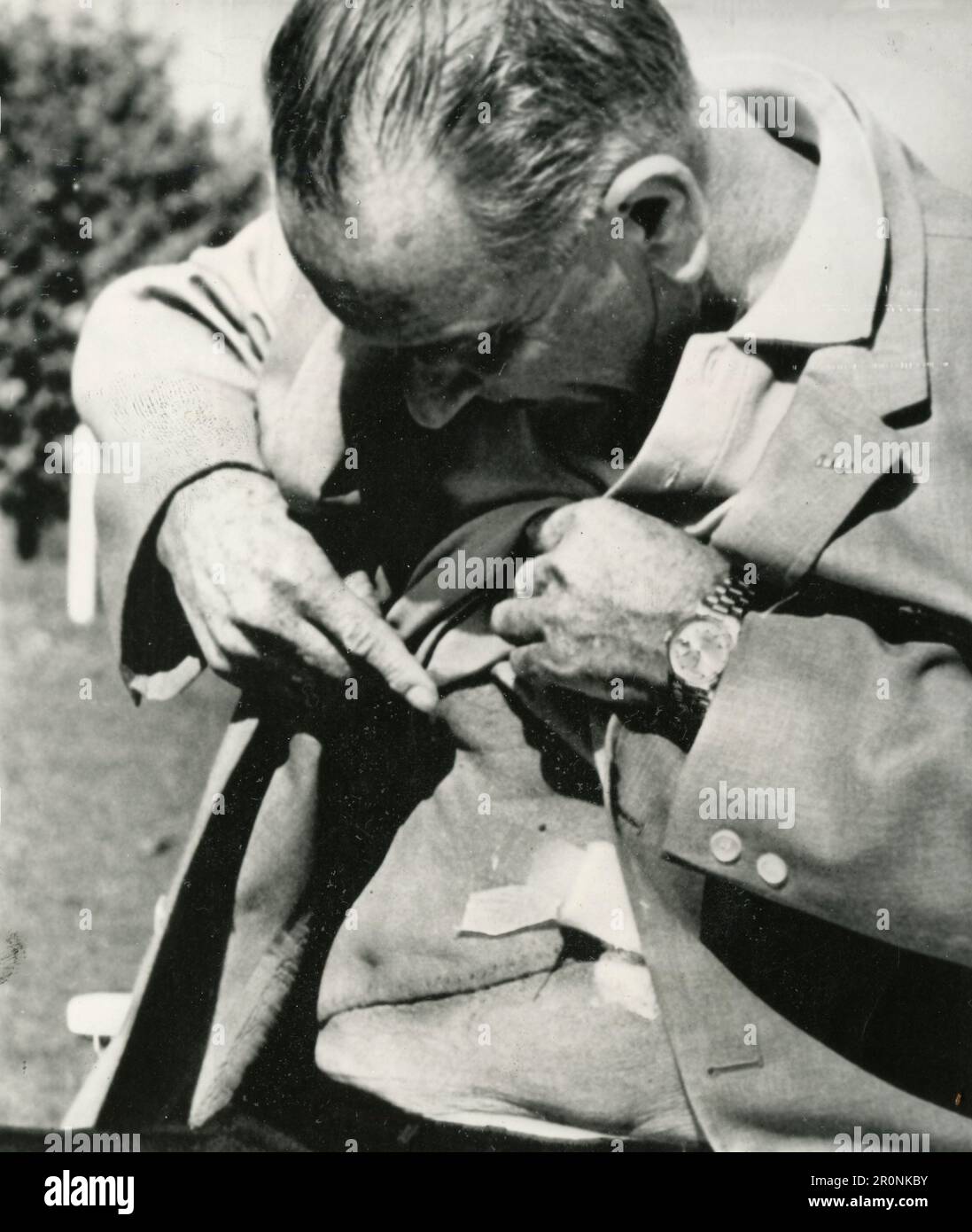 US President Lyndon Johnson showing his bladder surgery scar, Washington, USA 1965 Stock Photo