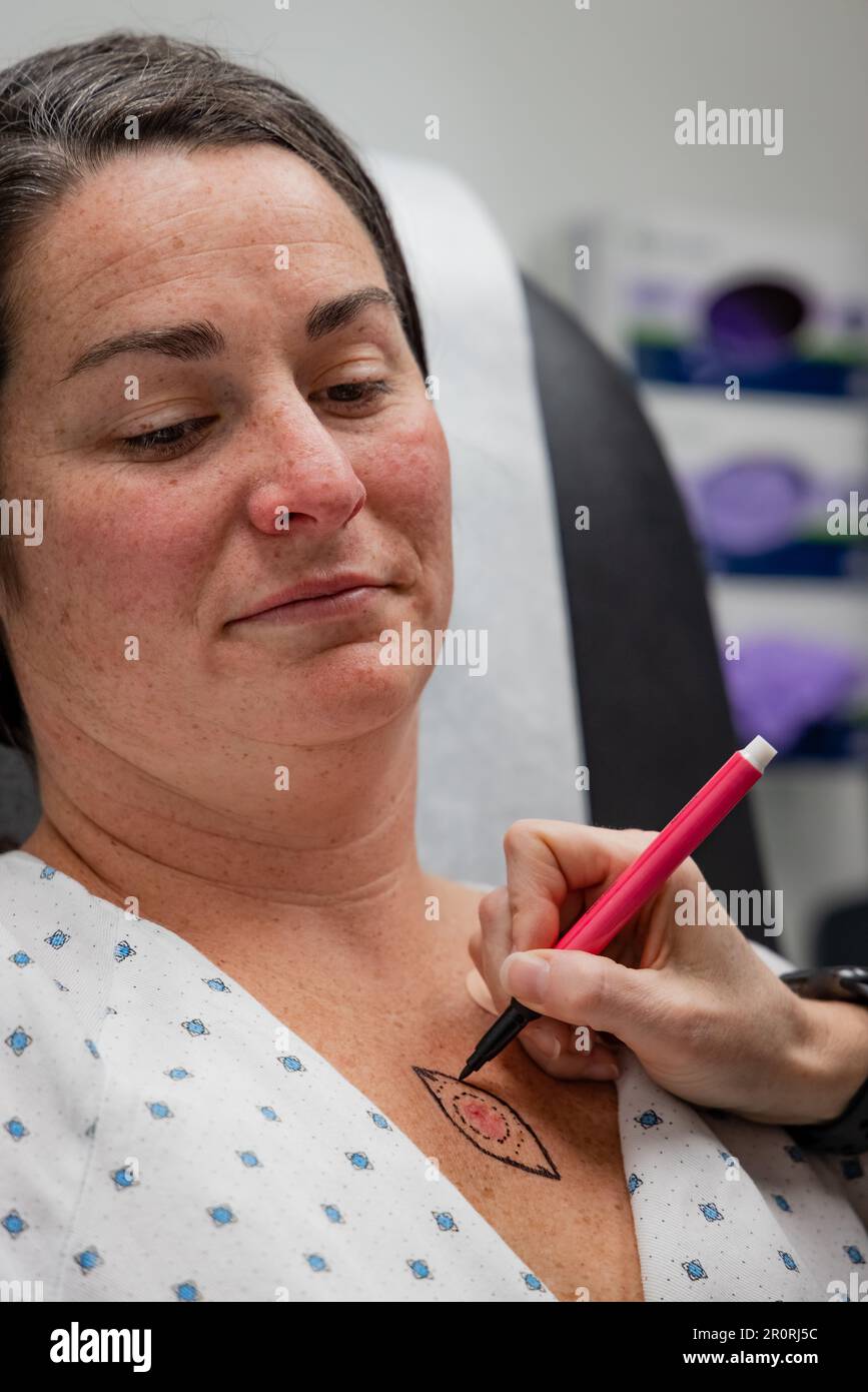 Dermatologist consults patient after drawing on young 30s woman chest