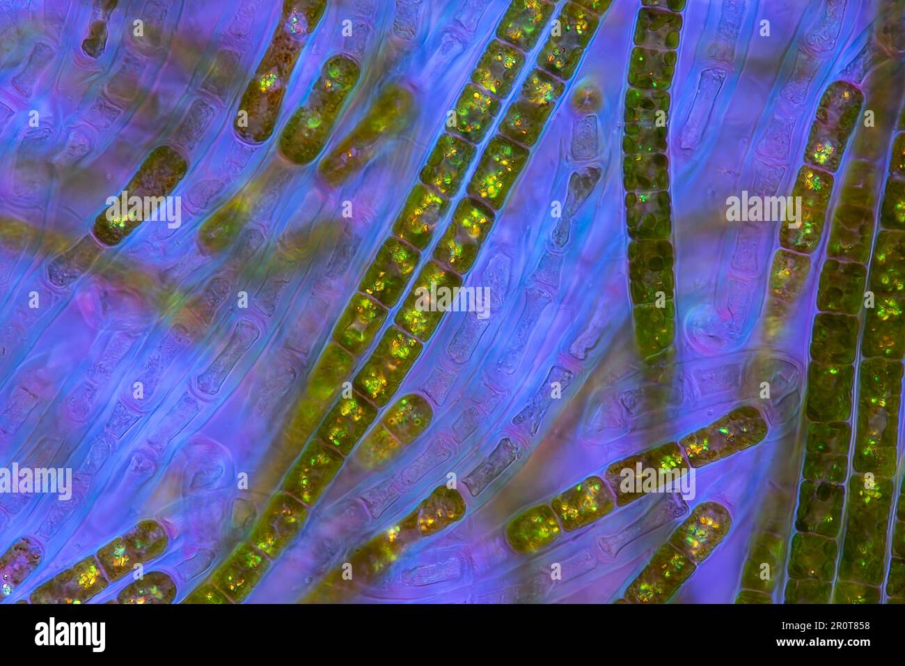 Tribonema algae, light micrograph Stock Photo - Alamy