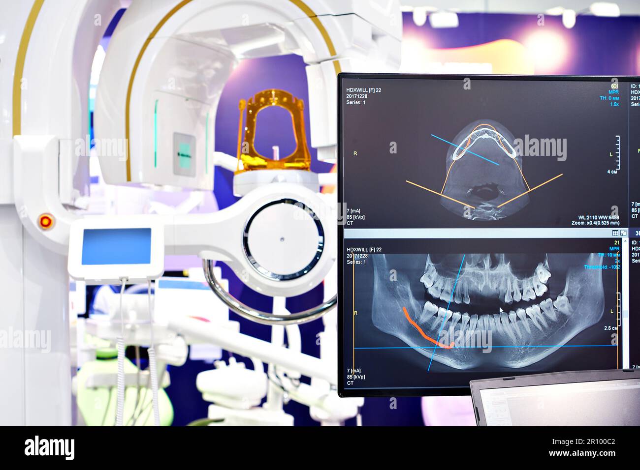 Modern dental digital 3D tomograph Stock Photo