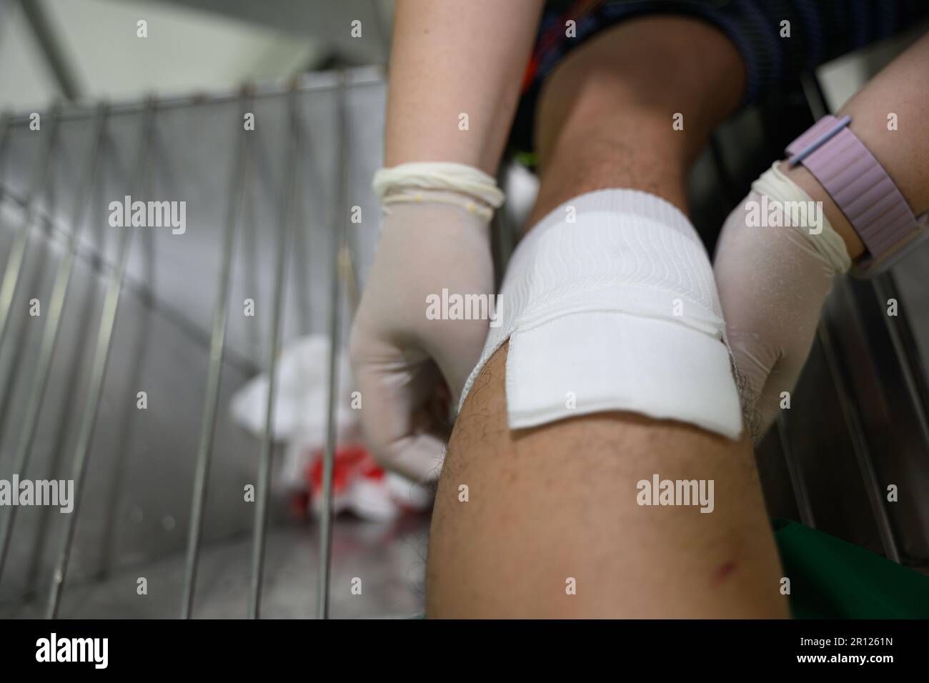 Nurses are treating a bleeding wound on the leg caused by an accident Stock Photo
