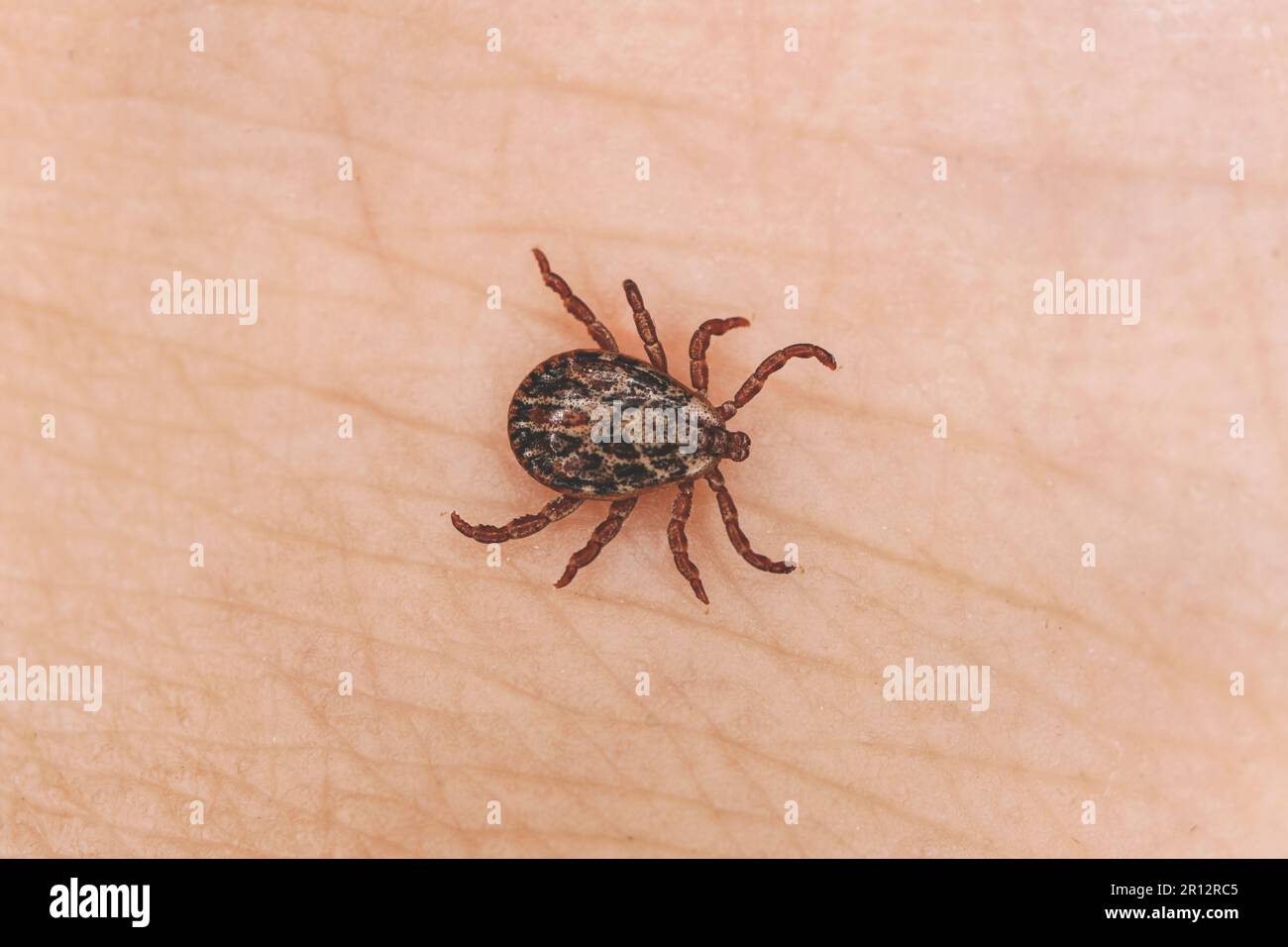 small brown insect mite crawls on human skin causing the risk of