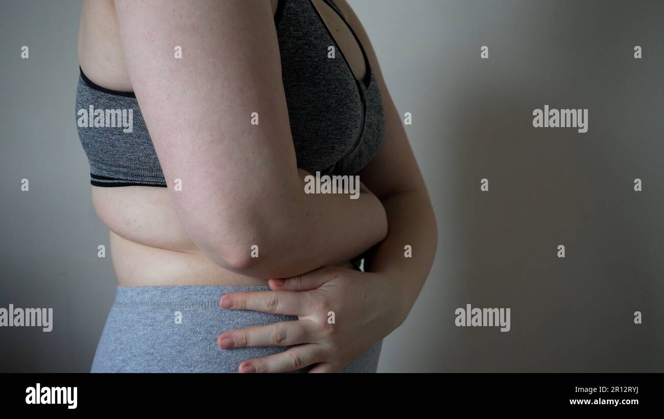 Close-up of fat folds on the large belly of an overweight woman ...