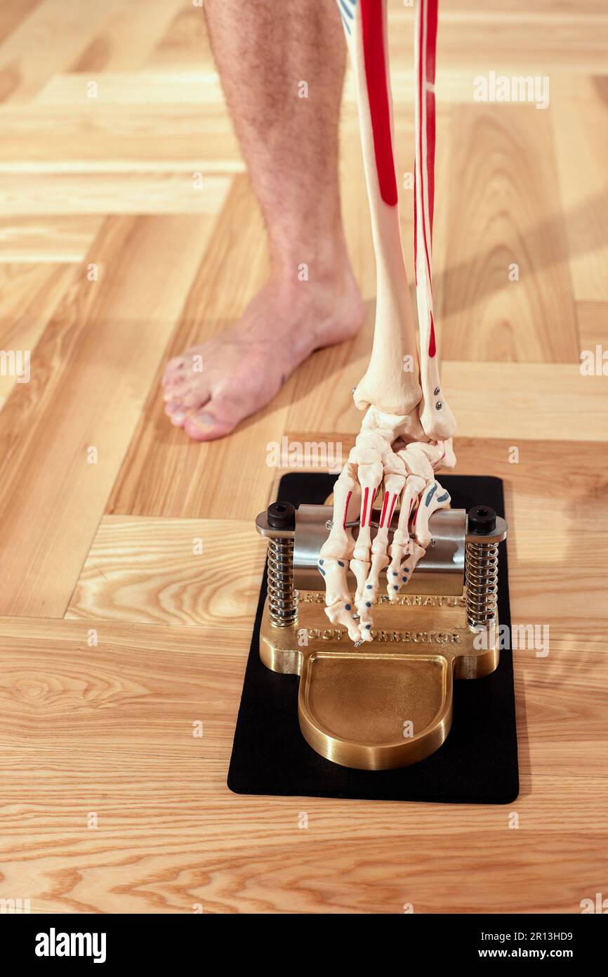 Diagnosis of flat feet human leg and medical skeleton and orthopedic