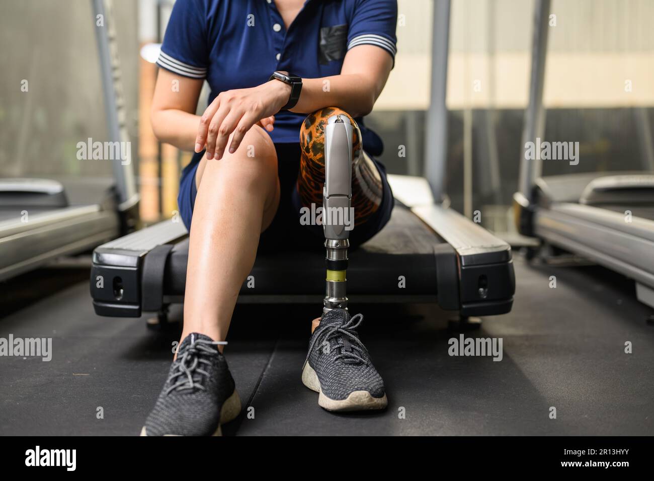 Disabled athlete patient with prosthetic leg doing exercise at gym Stock Photo Alamy