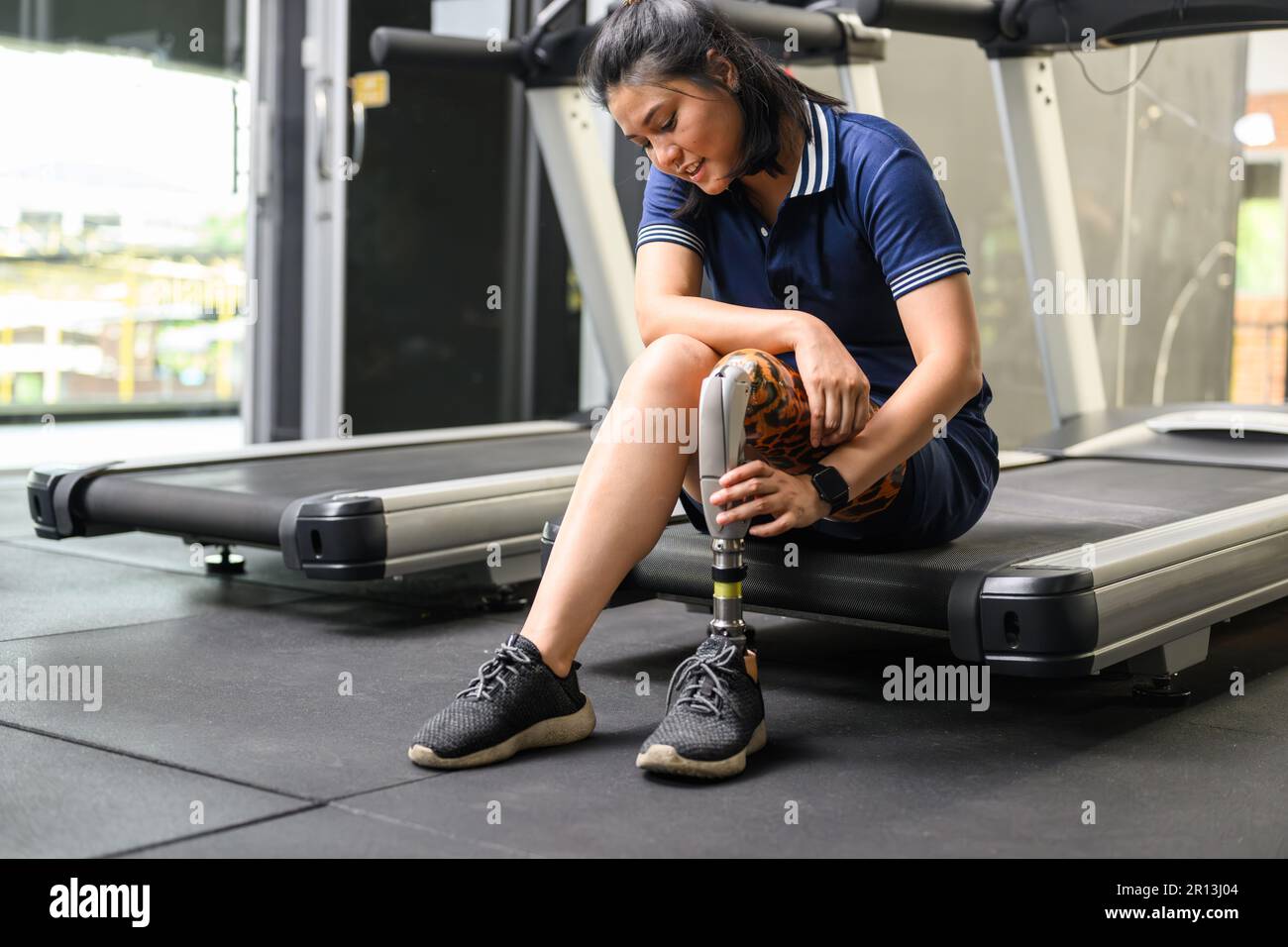 Disabled athlete patient with prosthetic leg doing exercise at gym ...