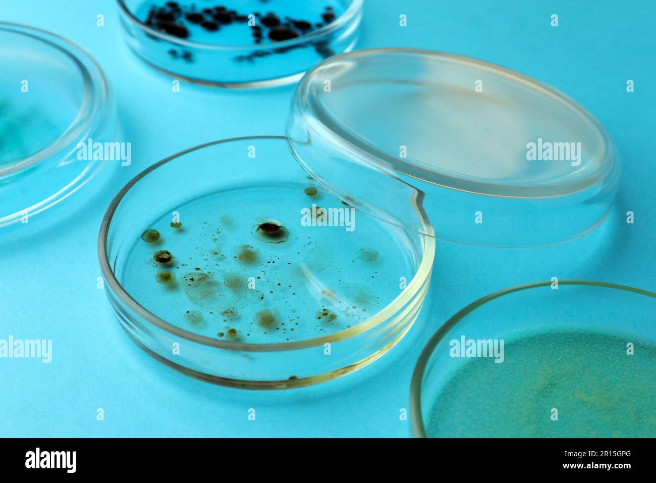 Petri dishes with different bacteria colonies on light blue background ...