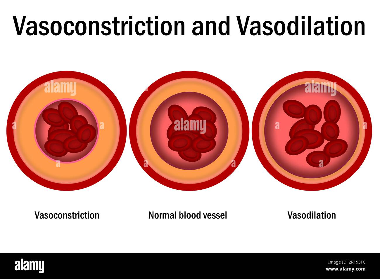 Comparison of normal, vasoconstriction and vasodilation blood vessels