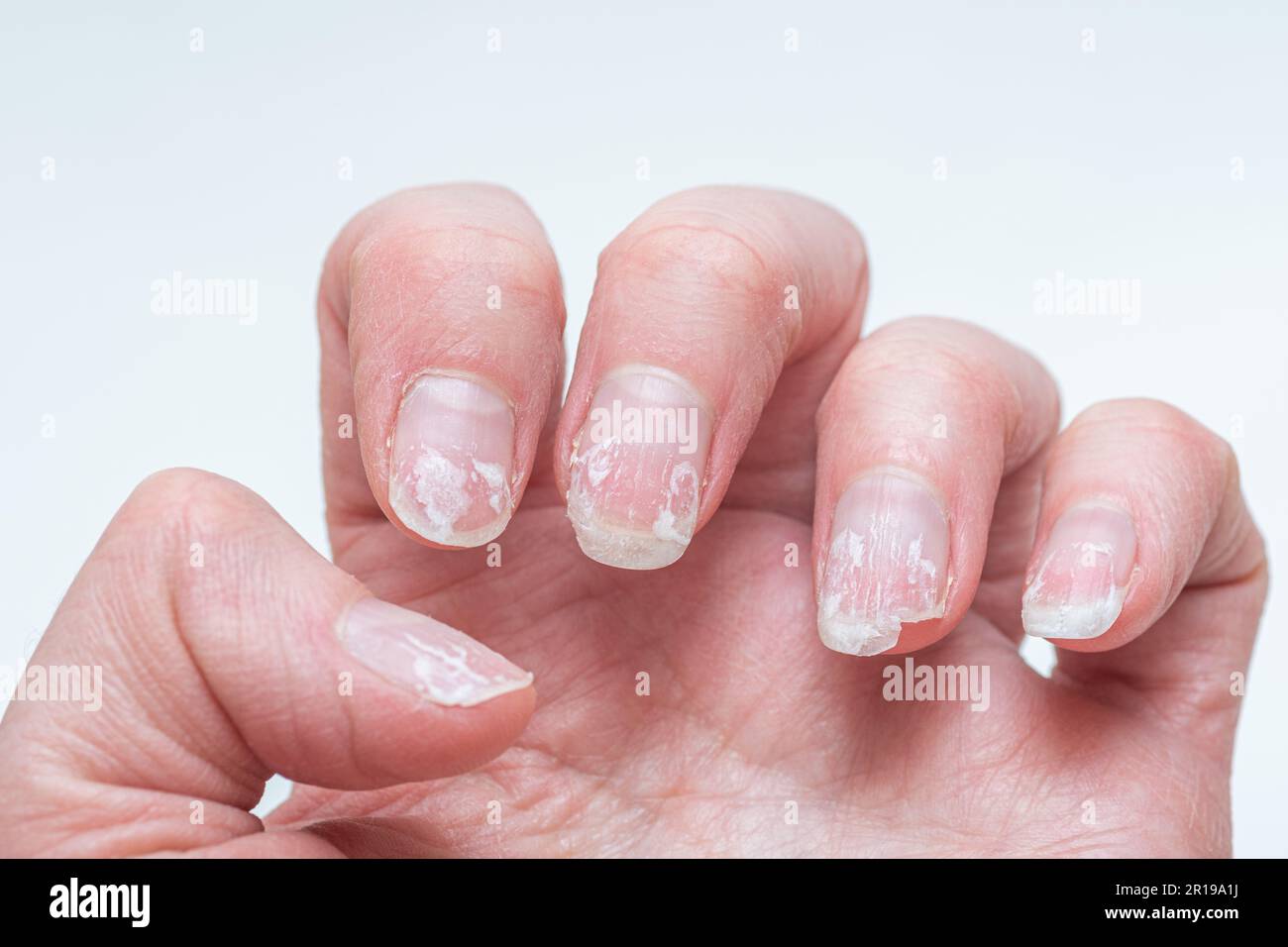 Top Nail Saving Tips For When Your Gels Grow Out | Nail Polish Direct