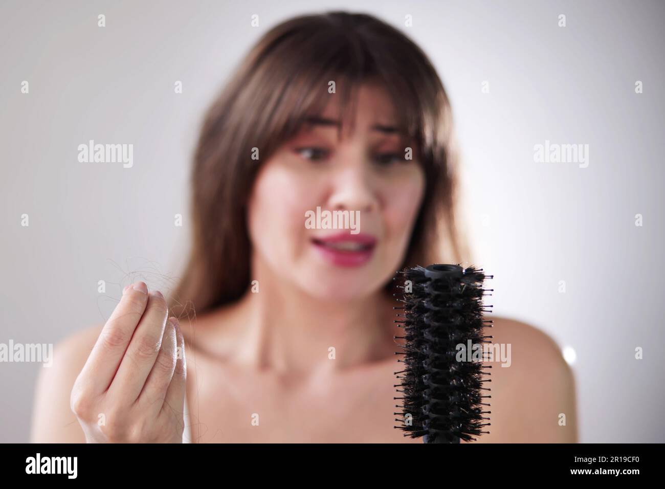 Hairfall And Hairloss. Worried Woman With Hair Loss Stock Photo