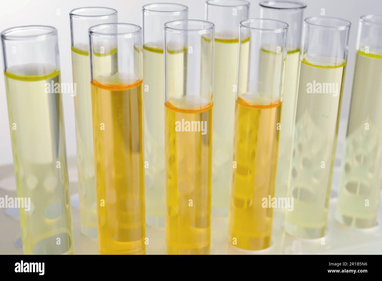 Tubes with urine samples for analysis on light grey background, closeup ...