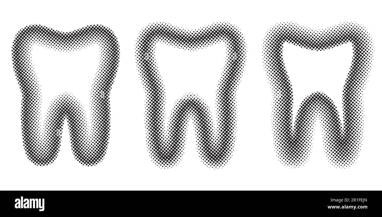 Tooth Set dots halftone effect, vector template teeth the molar halftone for logo design dental clinic Stock Vector