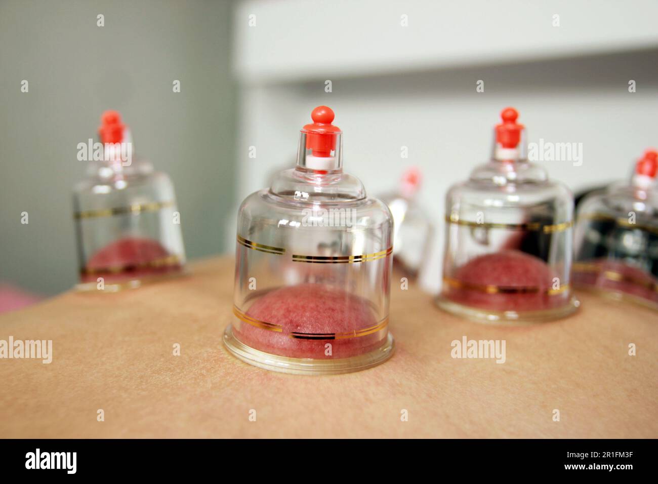 Concept image of cupping and medicine, a traditional oriental medicine