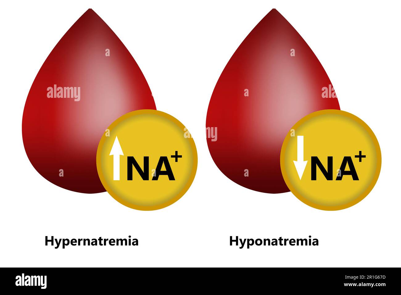 Hypernatremia and Hyponatremia with blood shape, 3d rendering Stock Photo