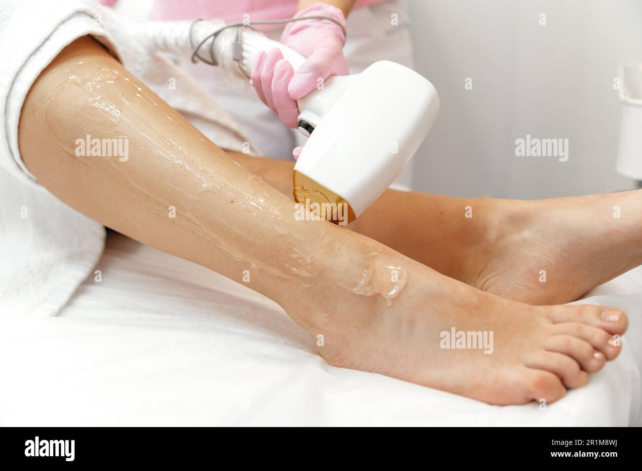 Laser epilation and cosmetology. Hair removal cosmetology procedure
