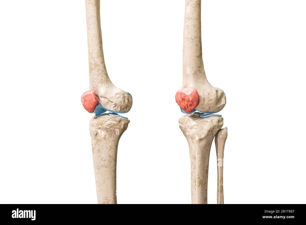 Knee best sale cap skeleton