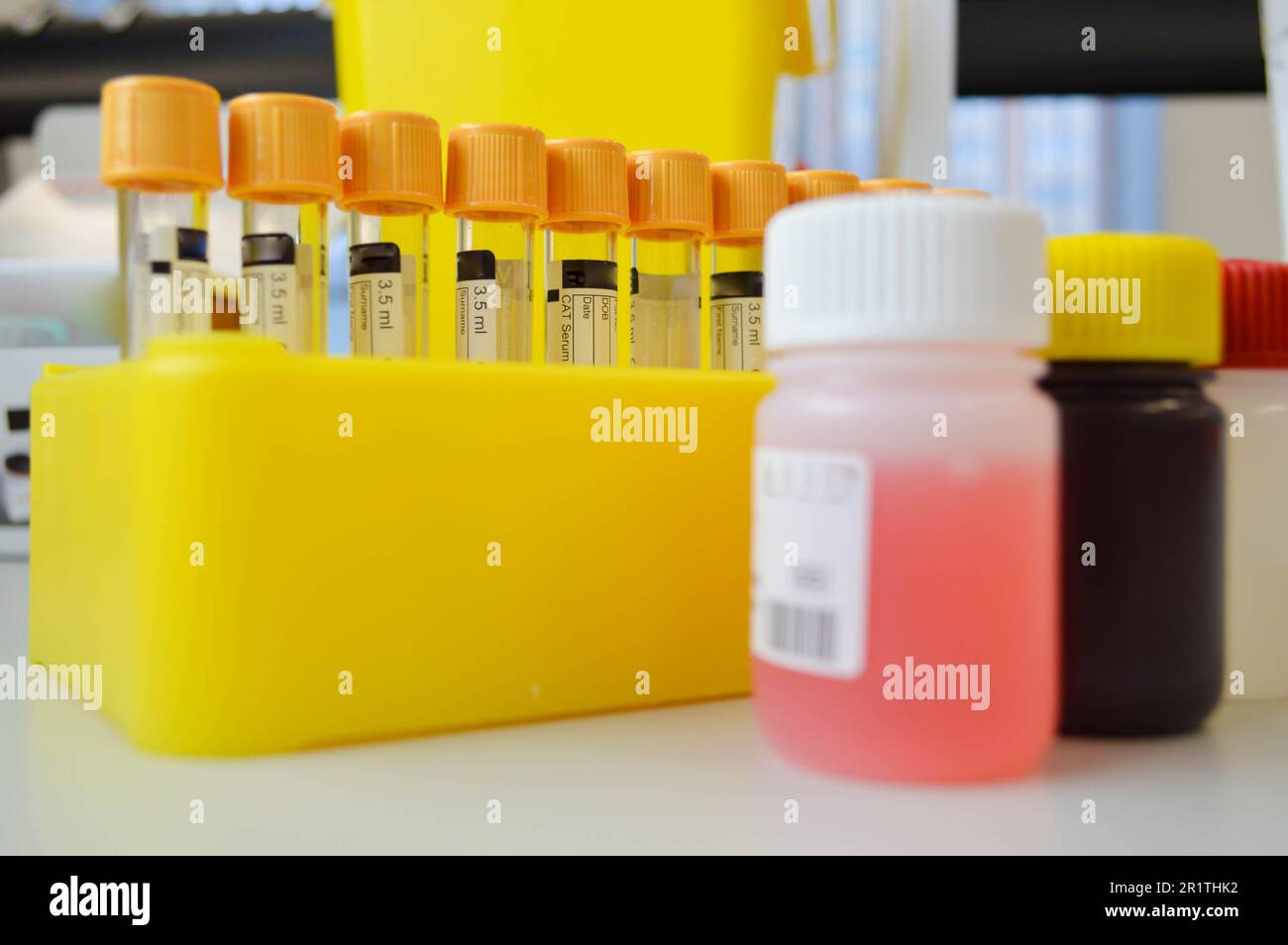 tubes in the holder next to liquid reagents for performing research. laboratory tests to detect