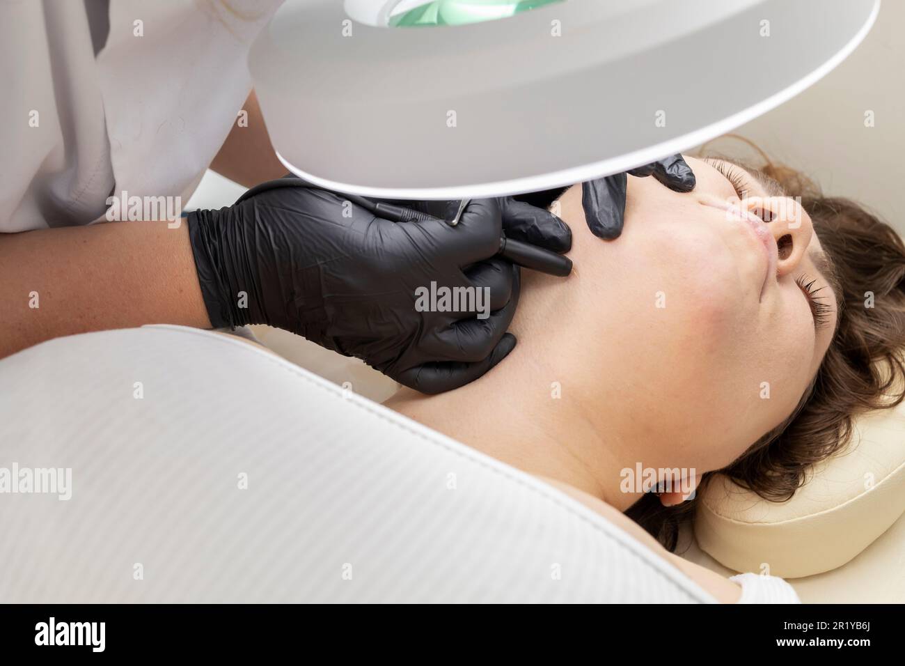 Process Of Hair Removal Treatment On Female Neck With Electrolysis. Electric Epilation In Beauty