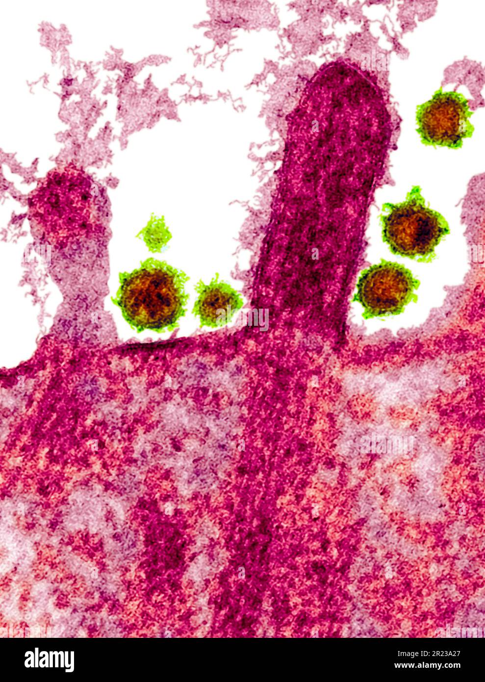 Cell infected by SARS-CoV-2 virus particles, TEM Stock Photo - Alamy