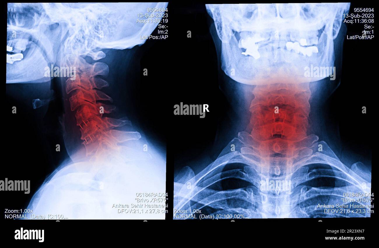 Medical Science Monitor A Natural-Position X-Ray For